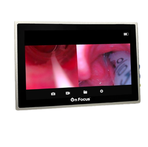 Pantalla OnFocus Advanced Duo